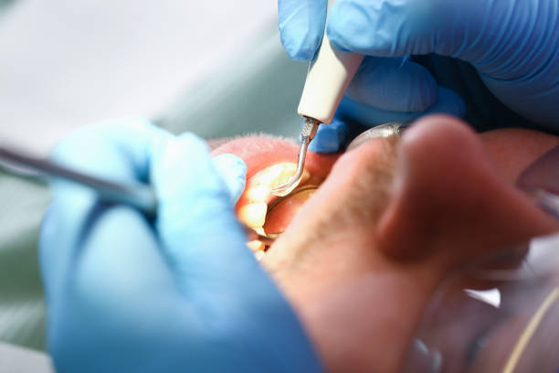 Best Emergency Dentist for Knocked-Out Tooth in Hampton, SC