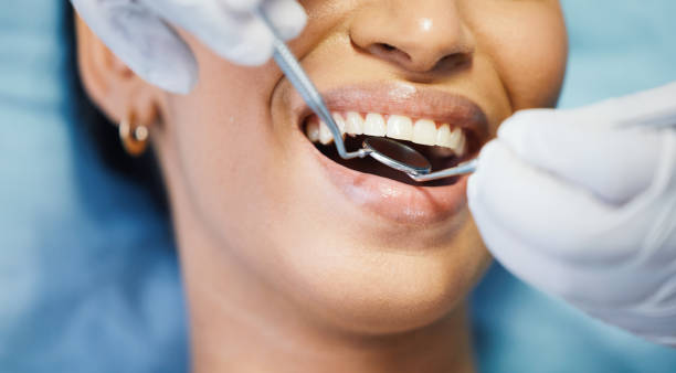 Best Urgent Dental Care for Toothache in Hampton, SC